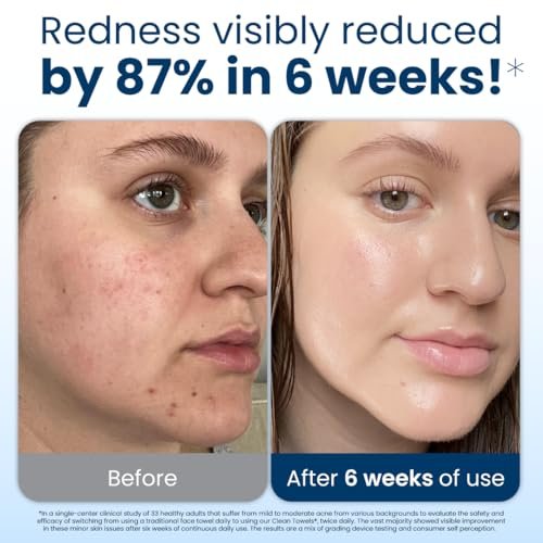 51G5dobg0fL.jpg Clean Skin Club Clean Towels XL®, 100% USDA Biobased Face Towel, Disposable Face Towelette, Eczema Association Accepted, Makeup Remover Dry Wipes, Ultra Soft, 50 Count